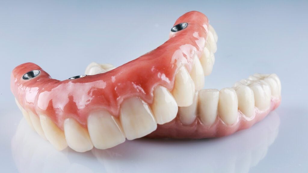 dentures muskogee dental implants